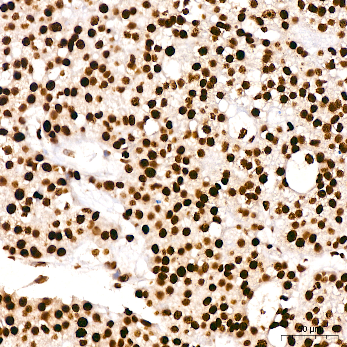Acetyl-Histone H3-K9 Rabbit mAb