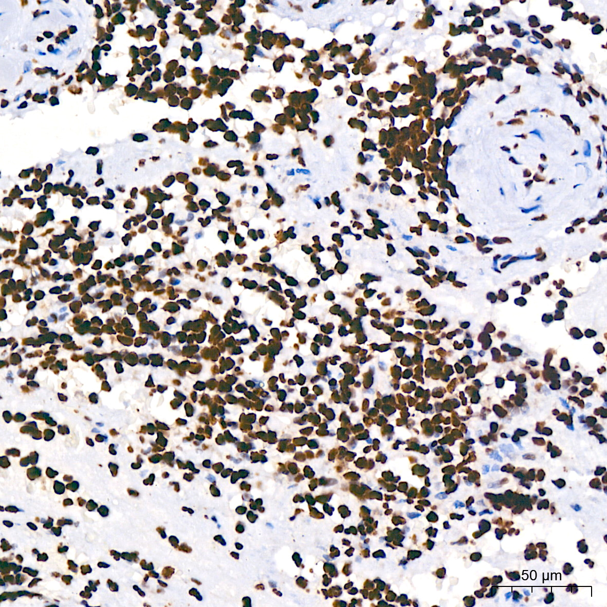 Acetyl-Histone H3-K9 Rabbit mAb