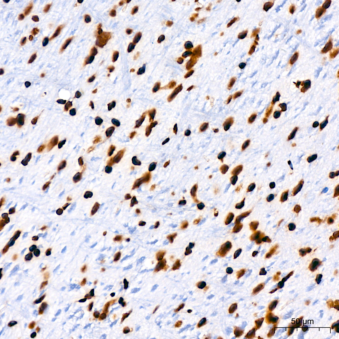 Acetyl-Histone H3-K9 Rabbit mAb