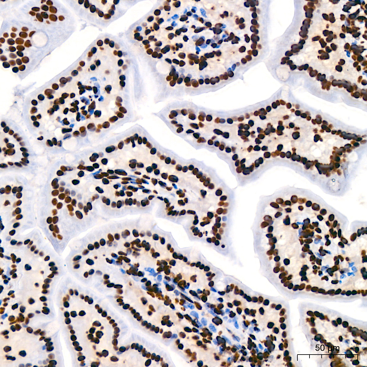Acetyl-Histone H3-K9 Rabbit mAb