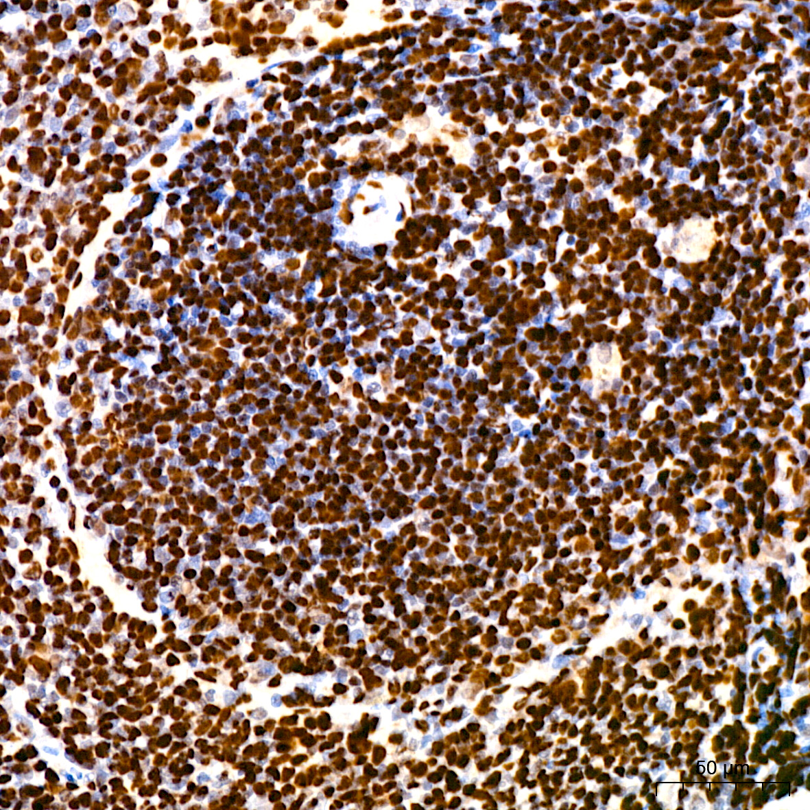 Acetyl-Histone H3-K9 Rabbit mAb