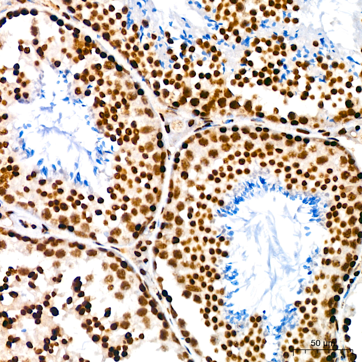 Acetyl-Histone H3-K9 Rabbit mAb