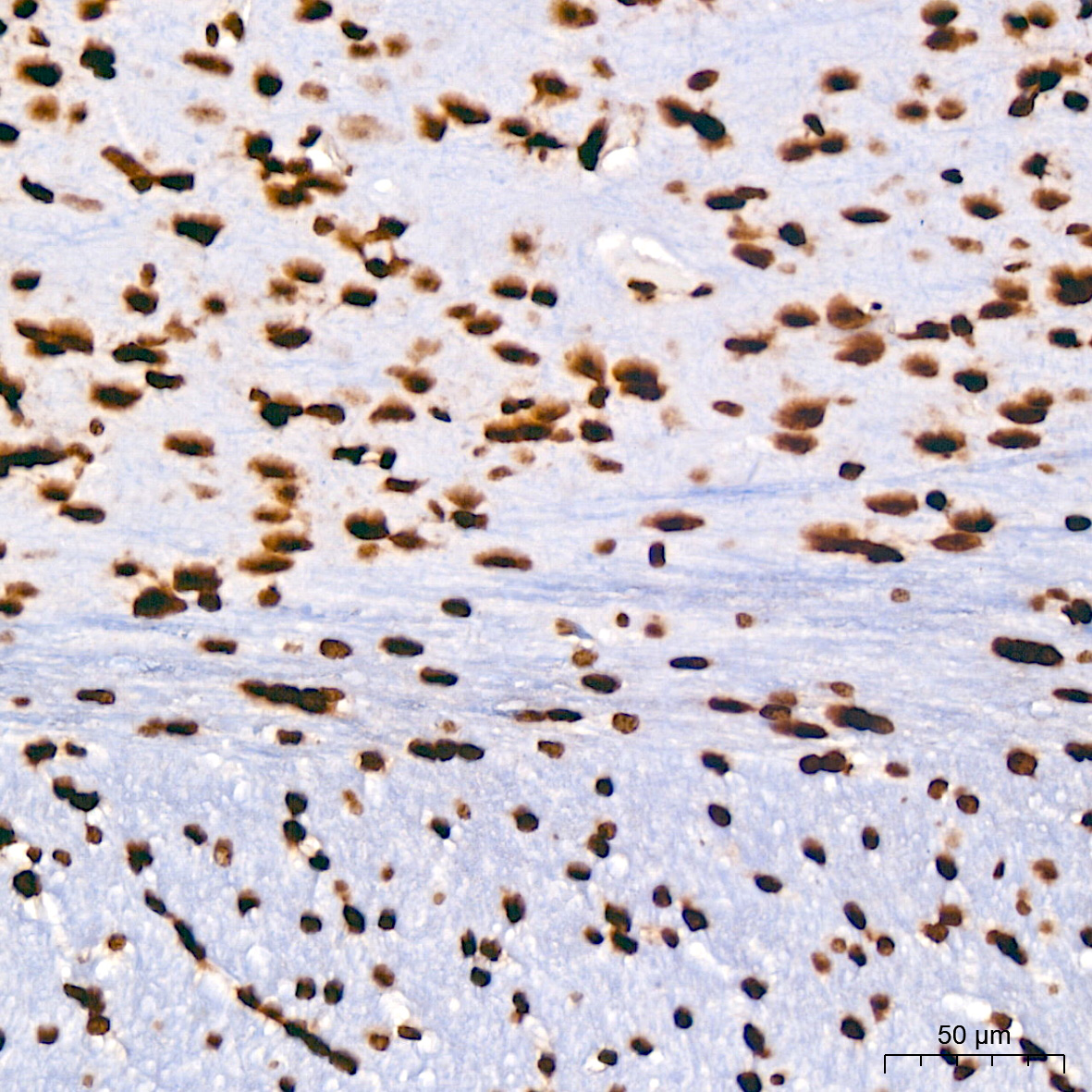 Acetyl-Histone H3-K9 Rabbit mAb