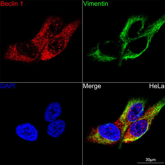 [KO Validated] Beclin 1 Rabbit mAb