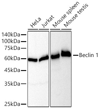 [KO Validated] Beclin 1 Rabbit mAb