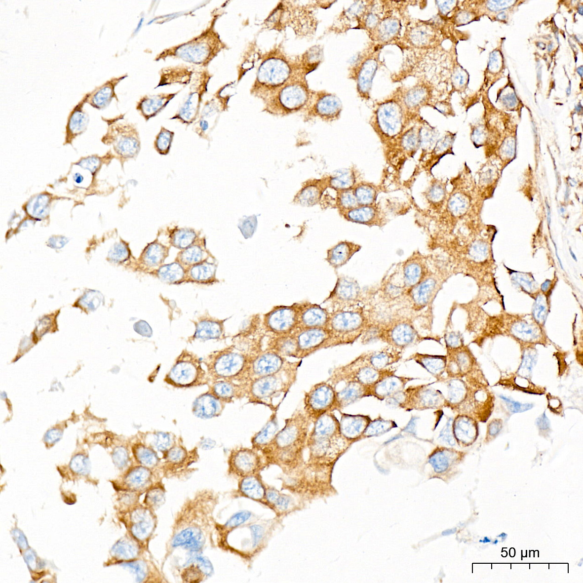 EIF4G2/p97 Rabbit mAb