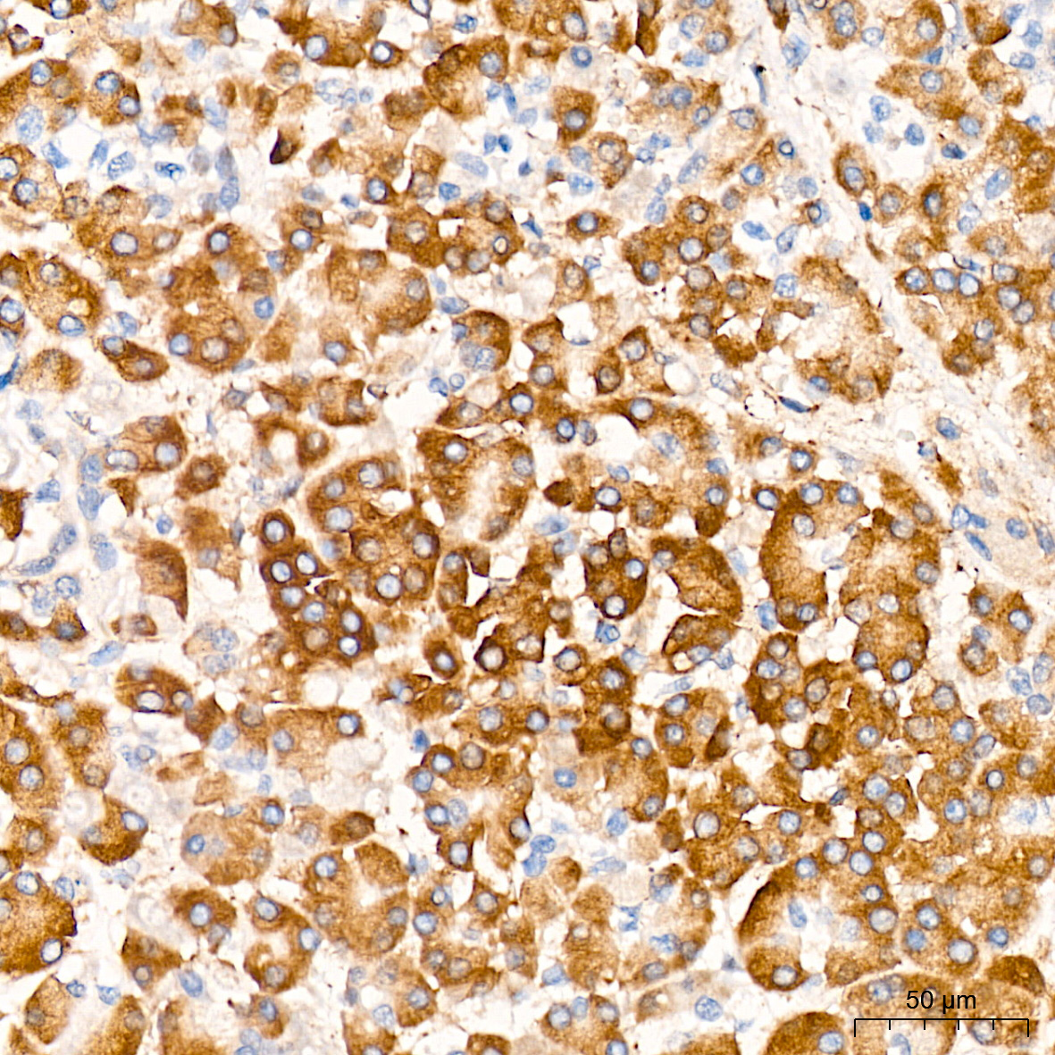 EIF4G2/p97 Rabbit mAb
