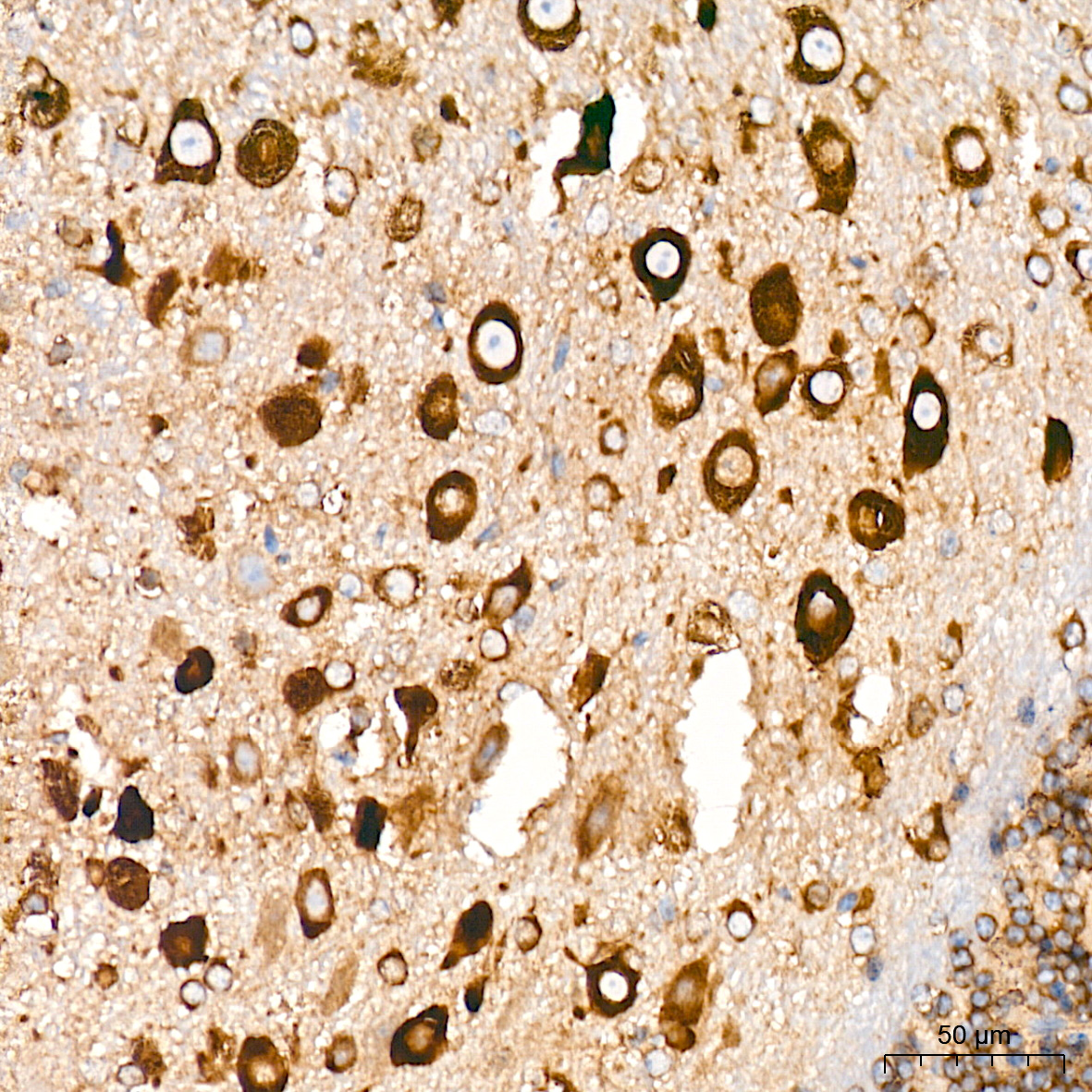 EIF4G2/p97 Rabbit mAb