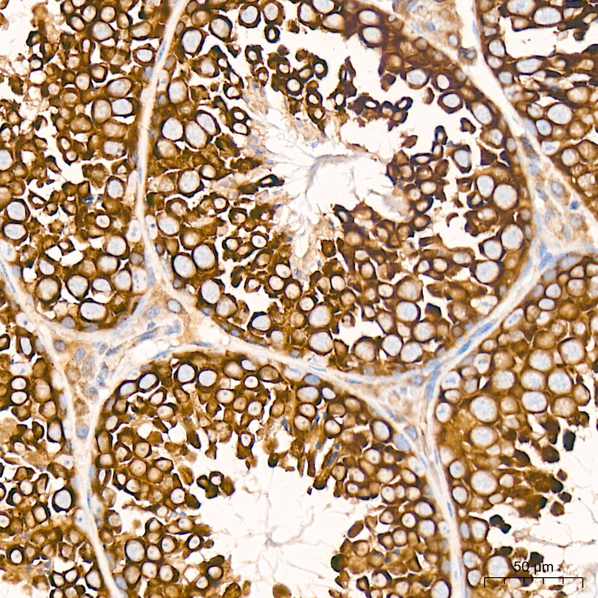 EIF4G2/p97 Rabbit mAb