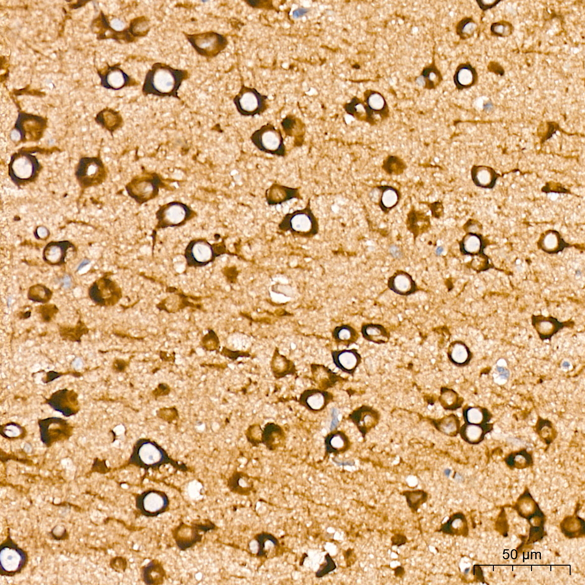 EIF4G2/p97 Rabbit mAb