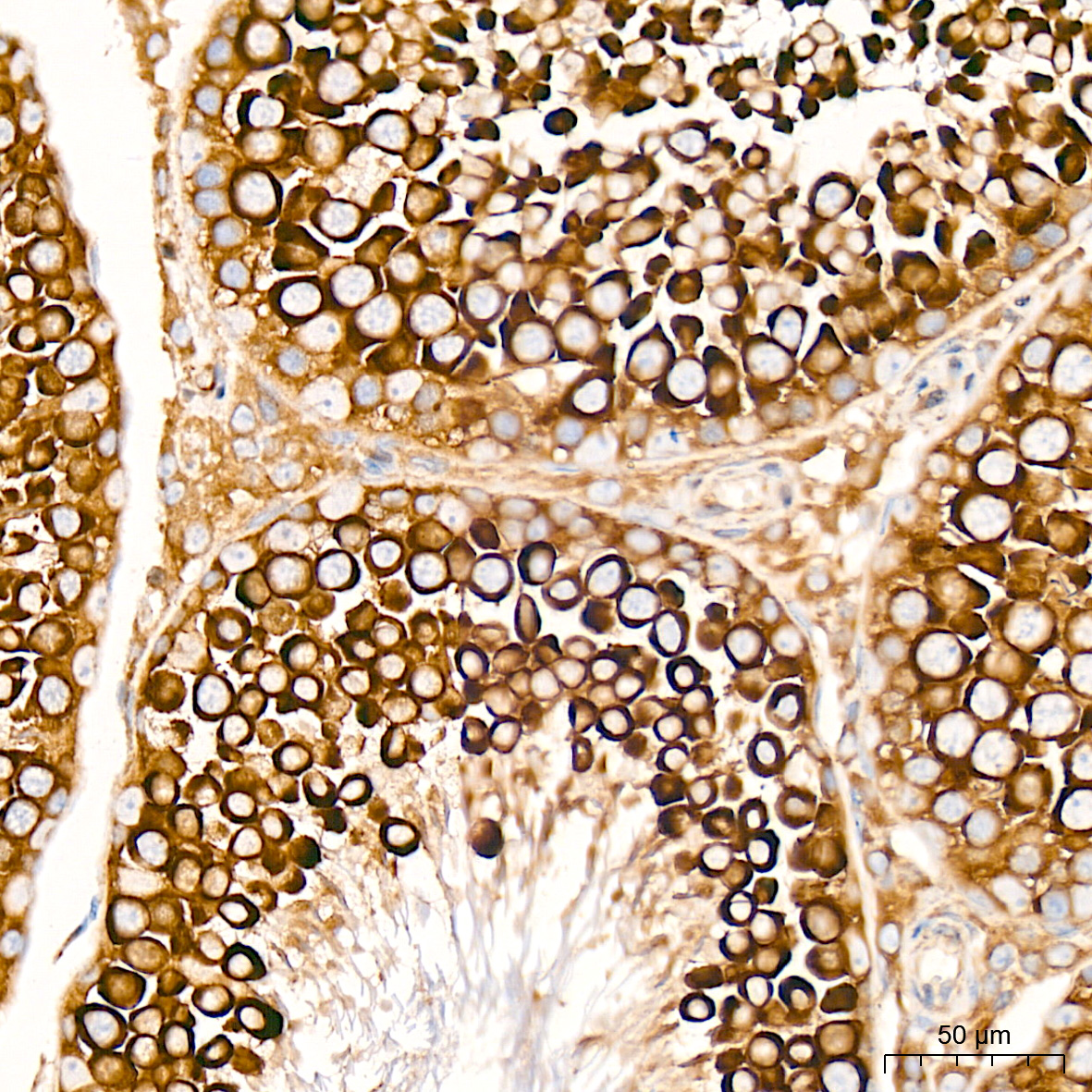 EIF4G2/p97 Rabbit mAb