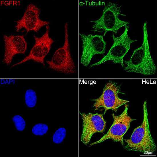 FGFR1 Rabbit mAb