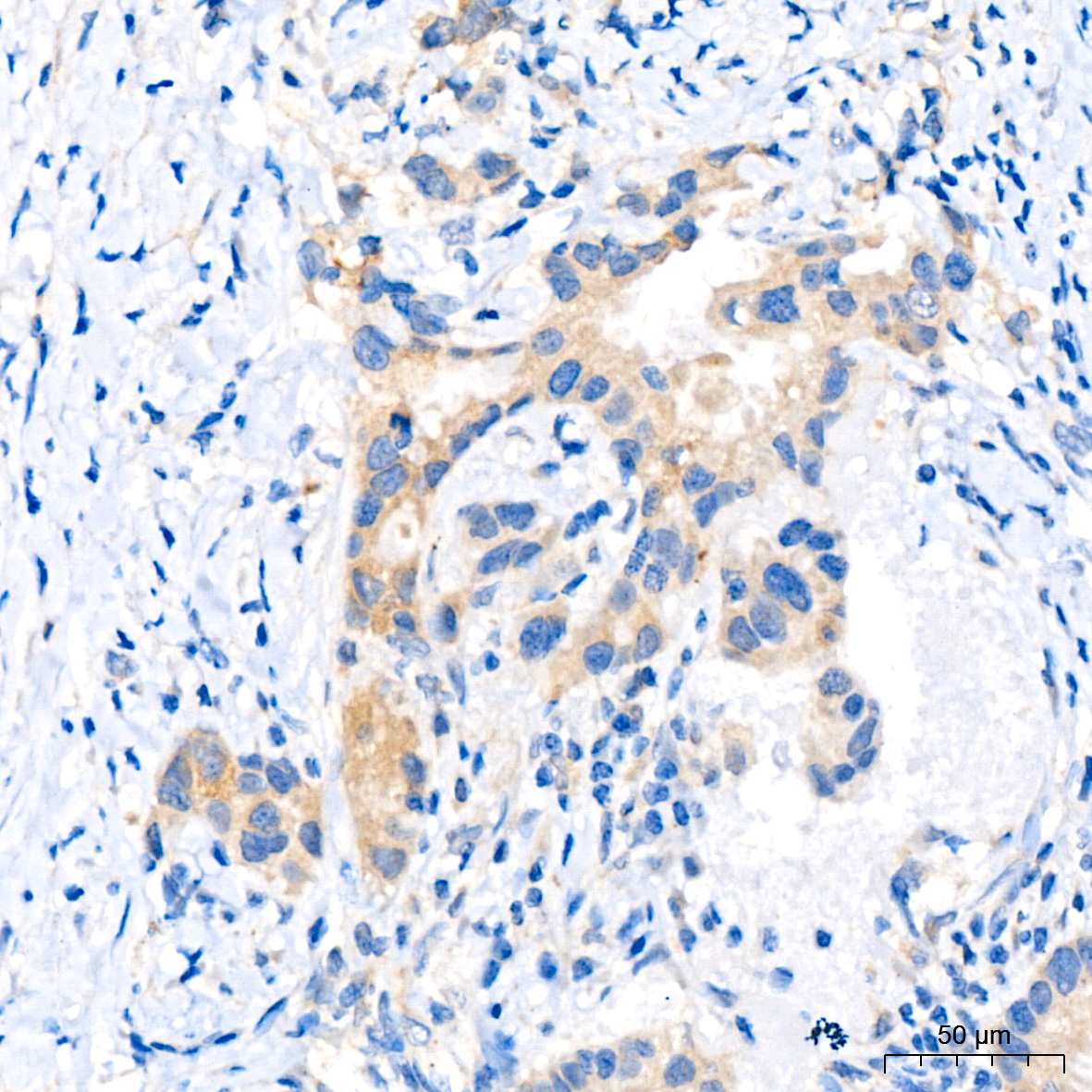 FGFR1 Rabbit mAb