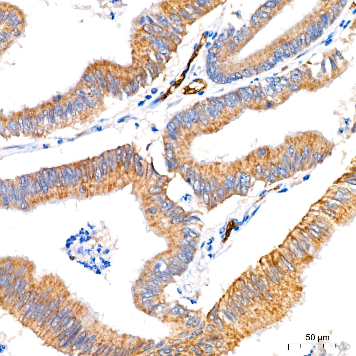 FGFR1 Rabbit mAb