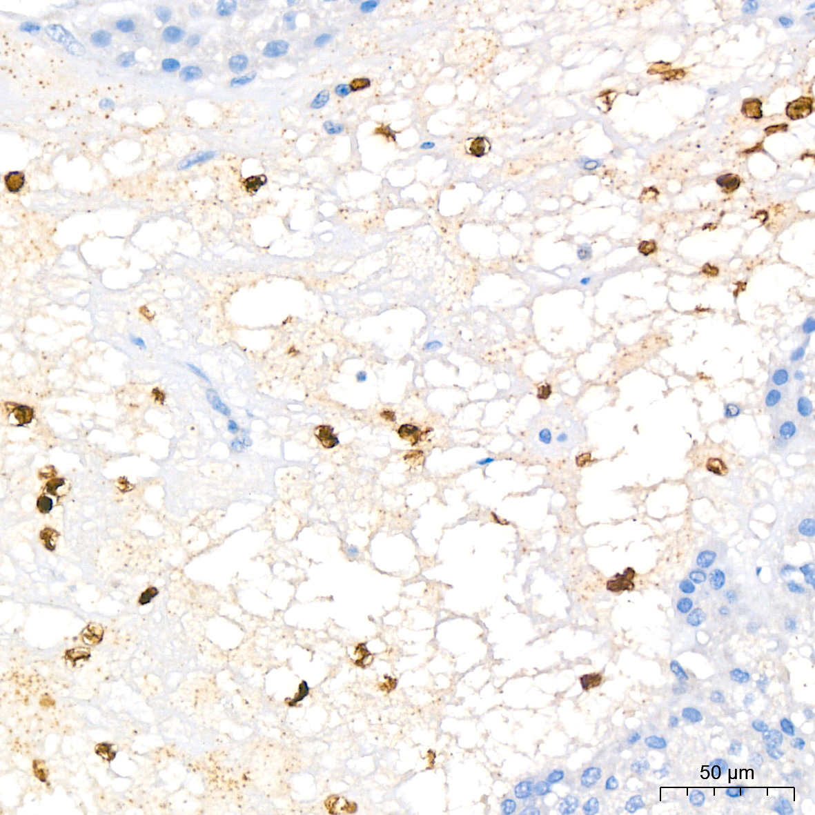 FGFR1 Rabbit mAb