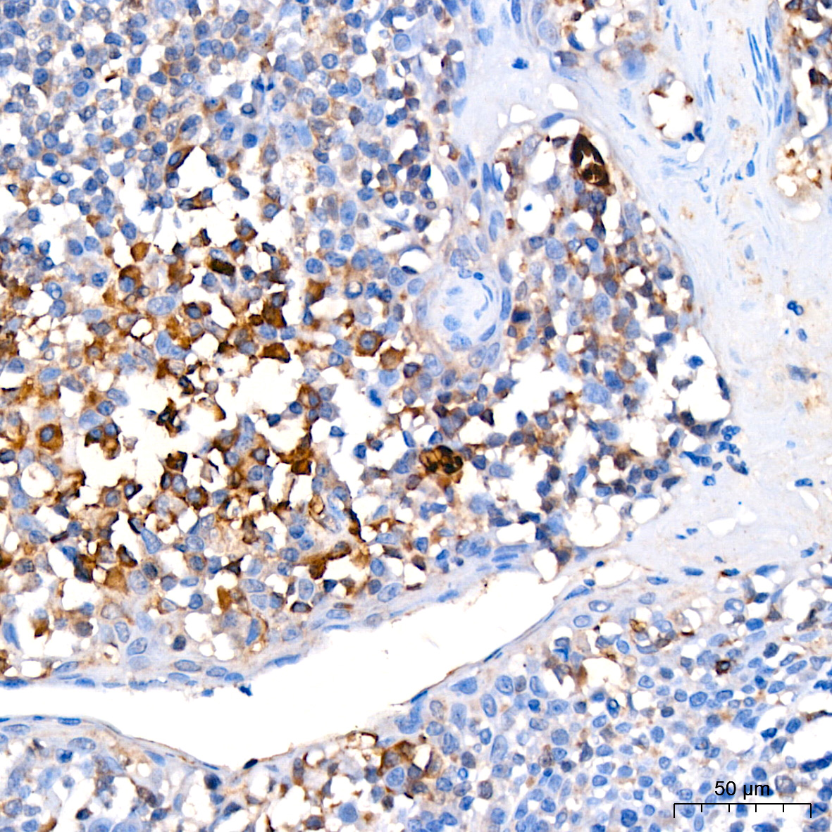 FGFR1 Rabbit mAb