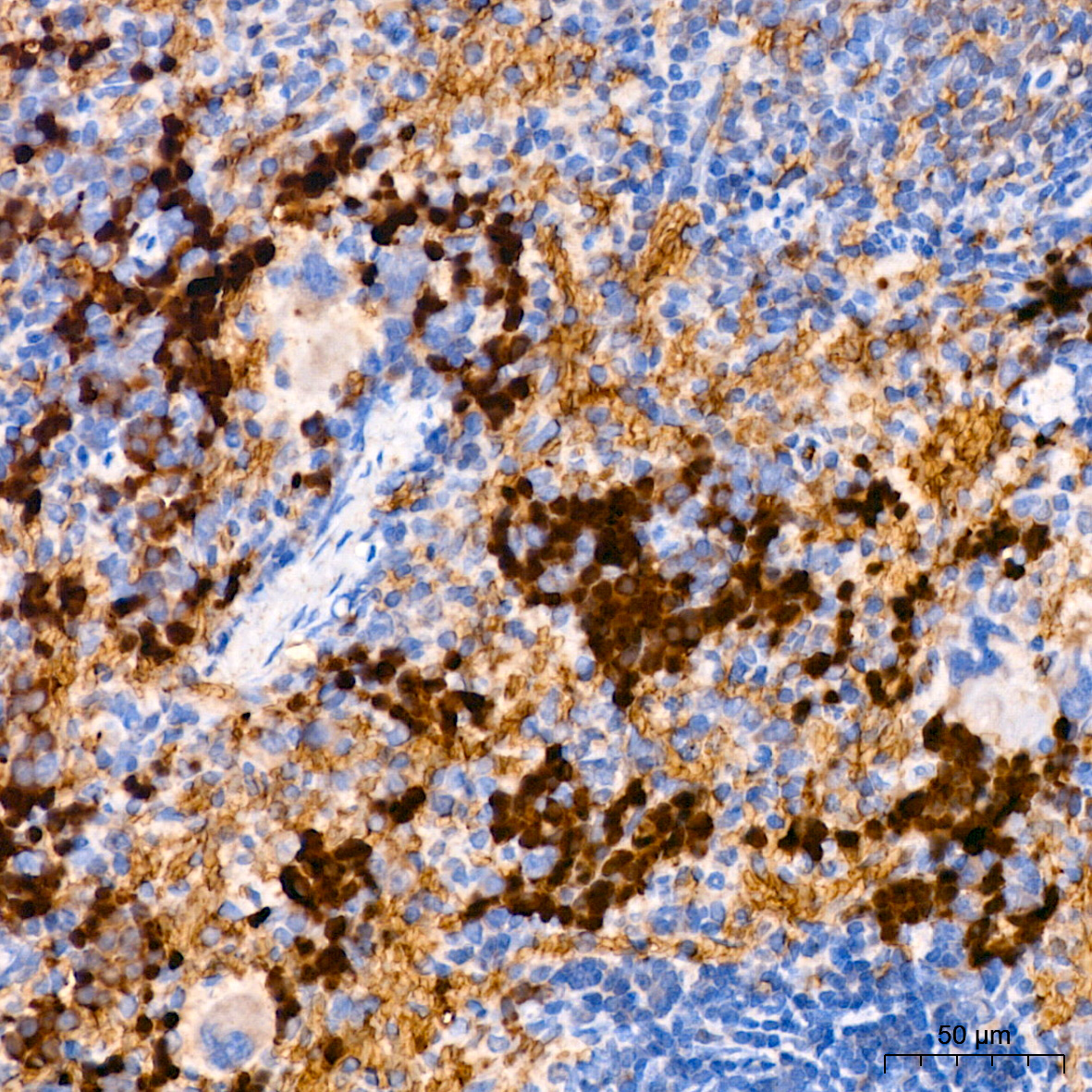 FGFR1 Rabbit mAb