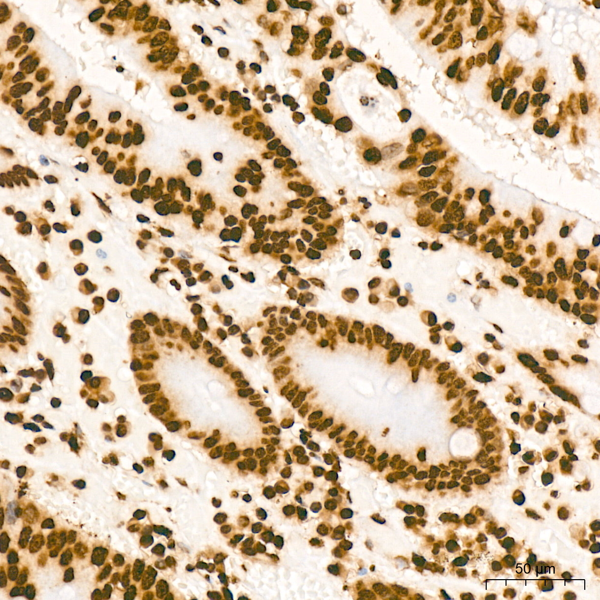 MonoMethyl-Histone H3-K79 Rabbit mAb