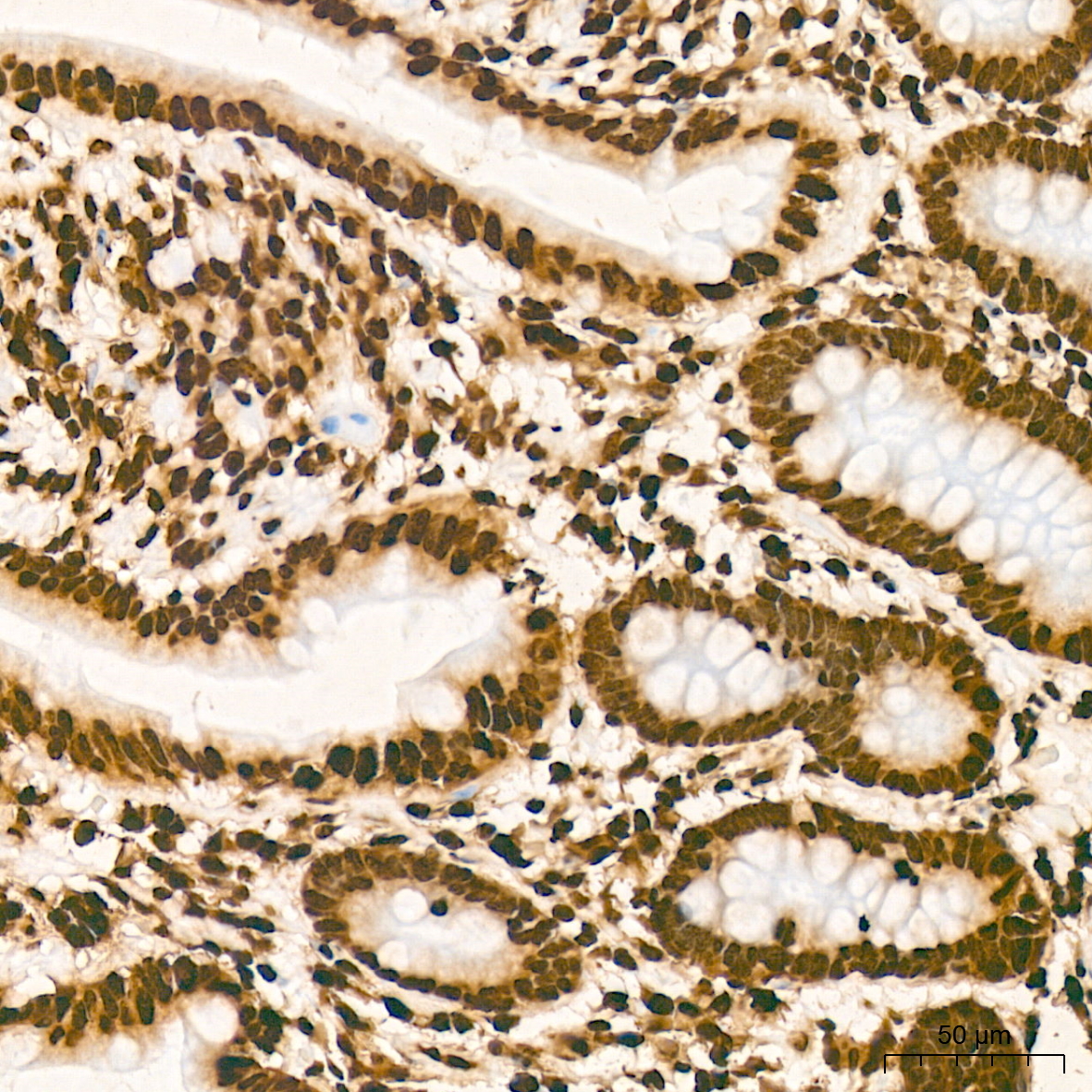 MonoMethyl-Histone H3-K79 Rabbit mAb