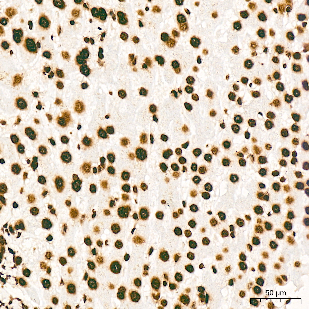 MonoMethyl-Histone H3-K79 Rabbit mAb