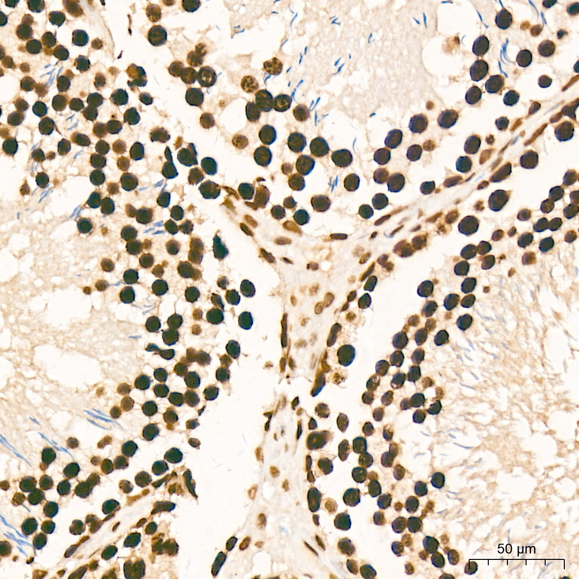 MonoMethyl-Histone H3-K79 Rabbit mAb