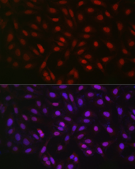 LKB1 Rabbit pAb