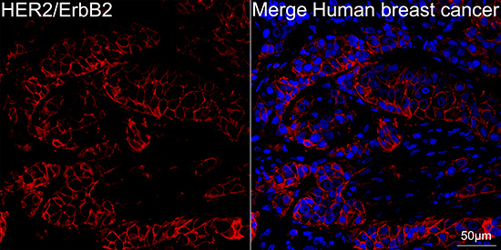 HER2/ErbB2 Rabbit mAb