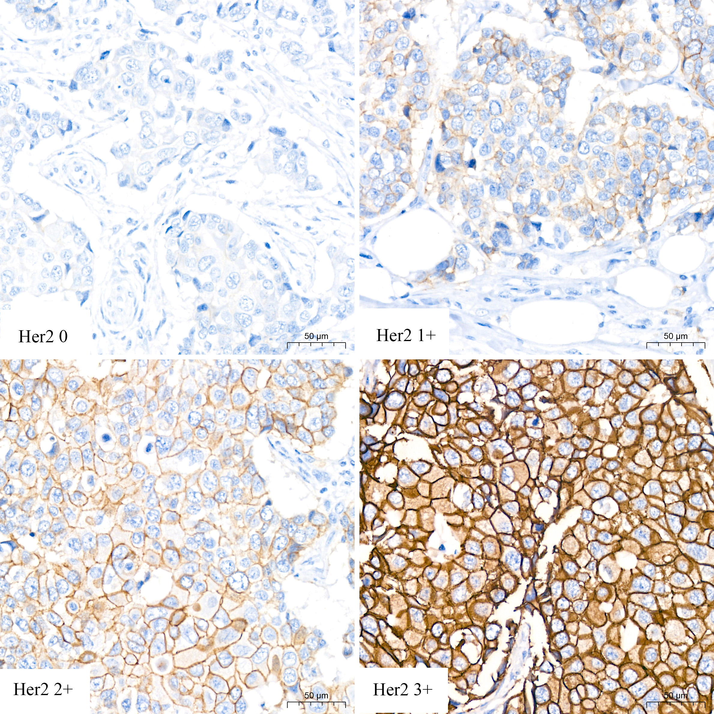 HER2/ErbB2 Rabbit mAb