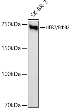 HER2/ErbB2 Rabbit mAb