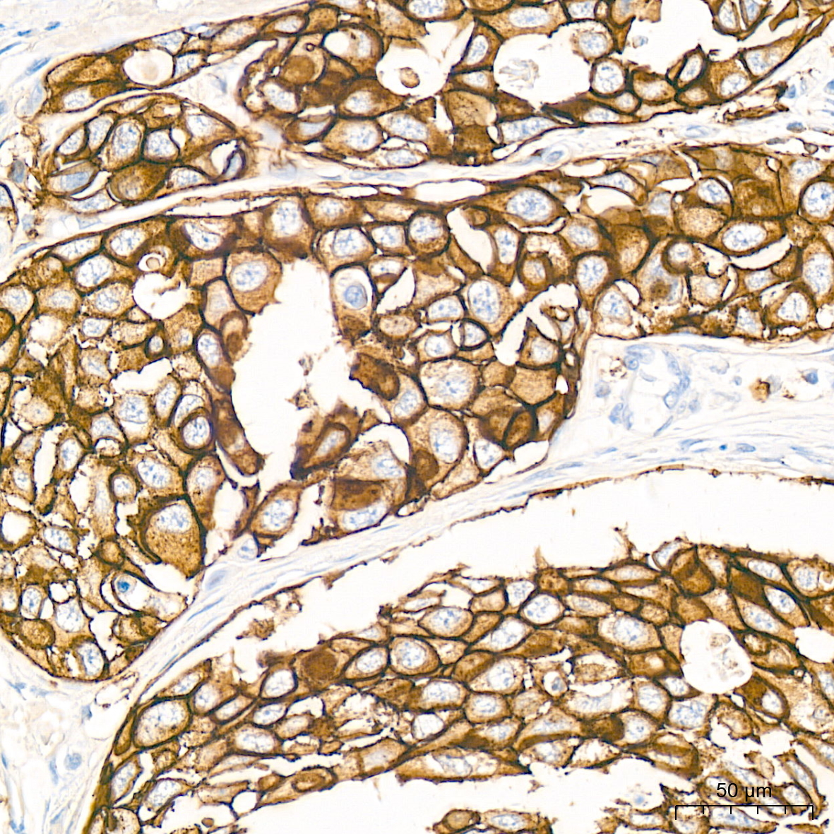 HER2/ErbB2 Rabbit mAb