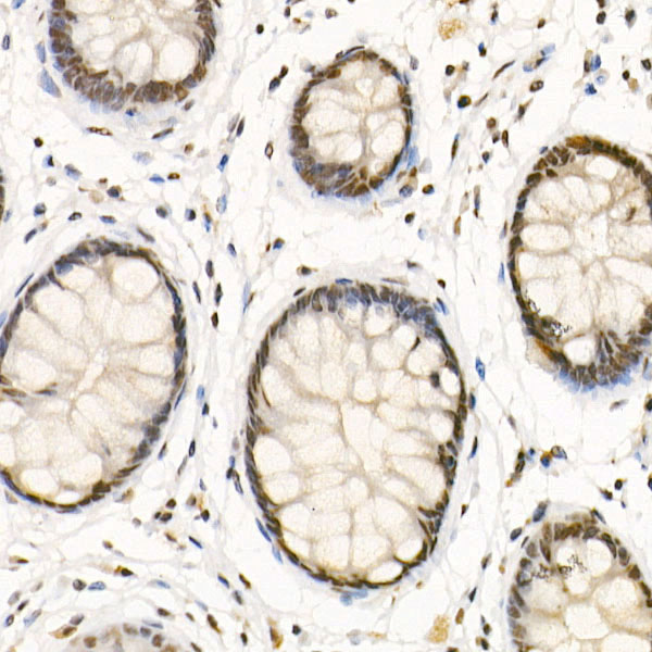 HDAC3 Rabbit pAb
