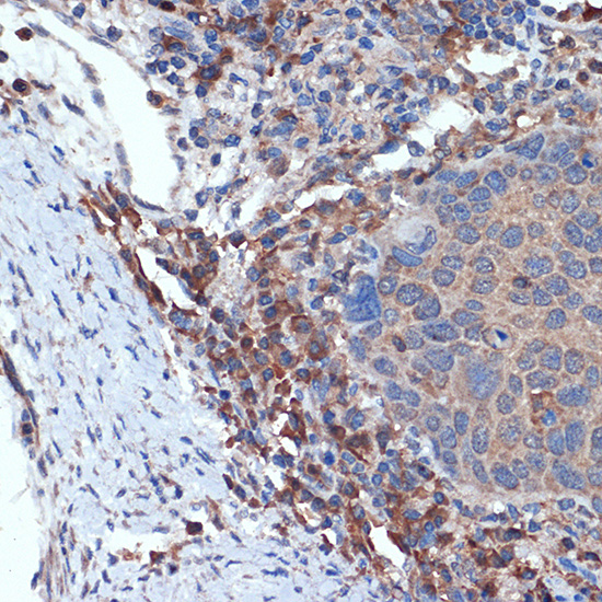 MLKL Rabbit mAb