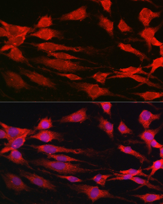 p70 S6 Kinase 1 Rabbit pAb