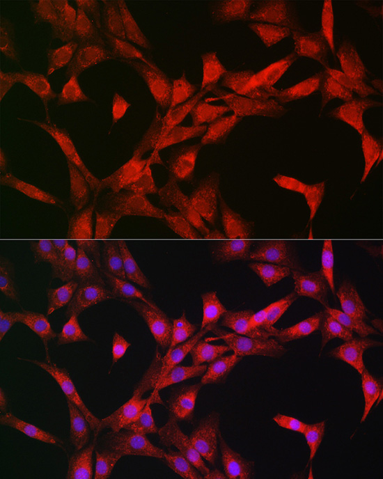 p70 S6 Kinase 1 Rabbit pAb
