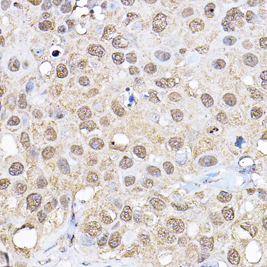 p70 S6 Kinase 1 Rabbit pAb