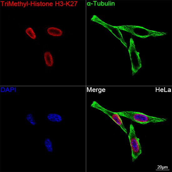 TriMethyl-Histone H3-K27 Rabbit mAb