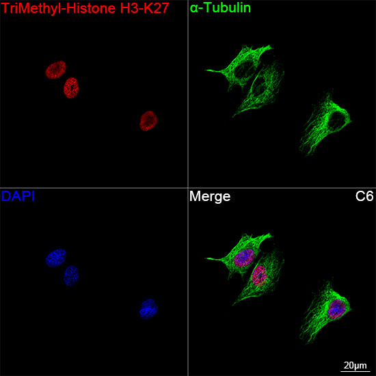 TriMethyl-Histone H3-K27 Rabbit mAb