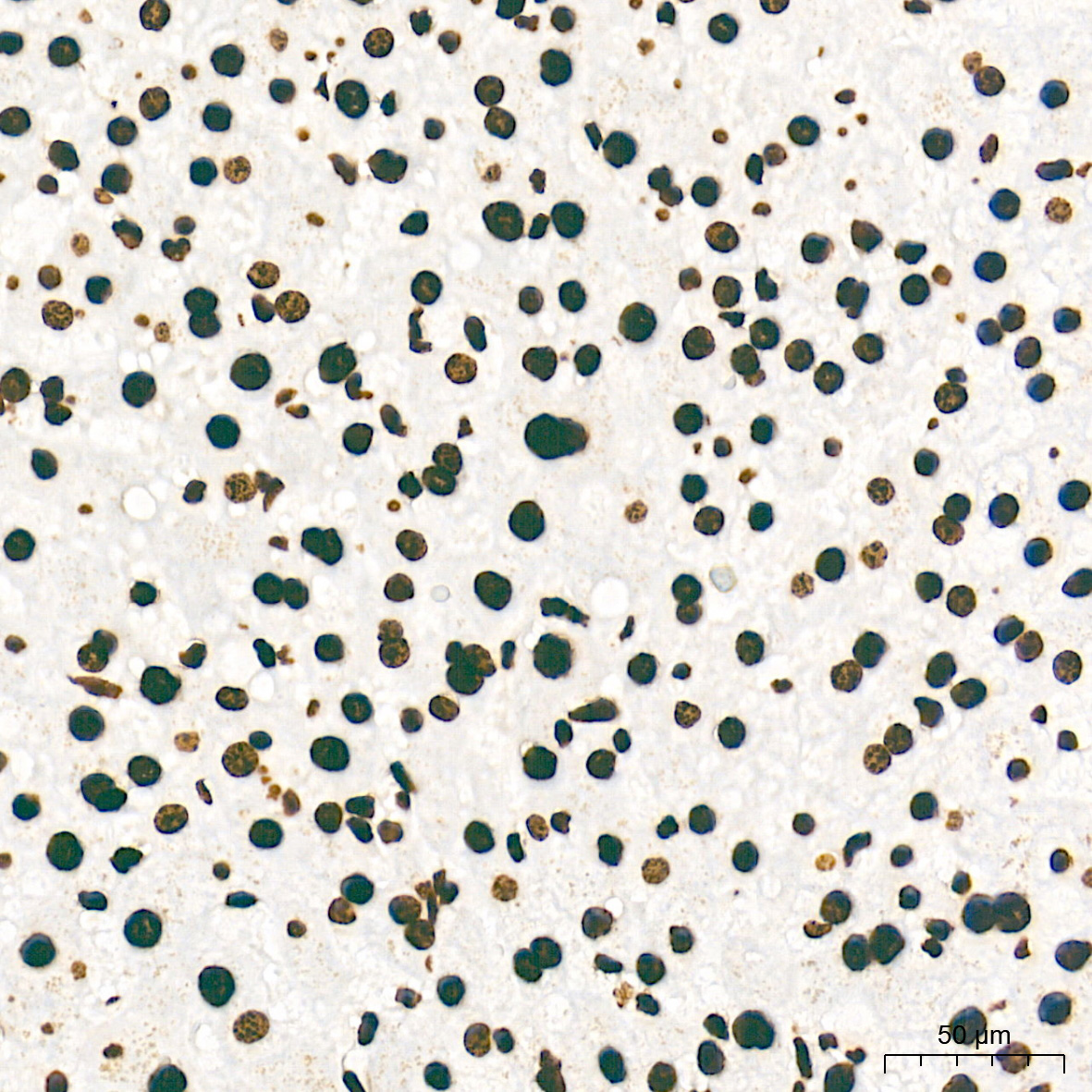 TriMethyl-Histone H3-K27 Rabbit mAb