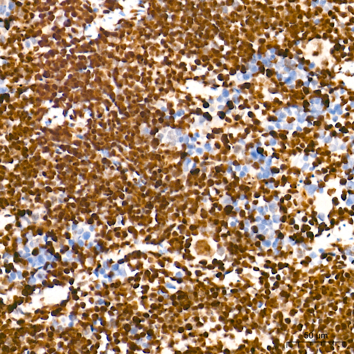 TriMethyl-Histone H3-K27 Rabbit mAb