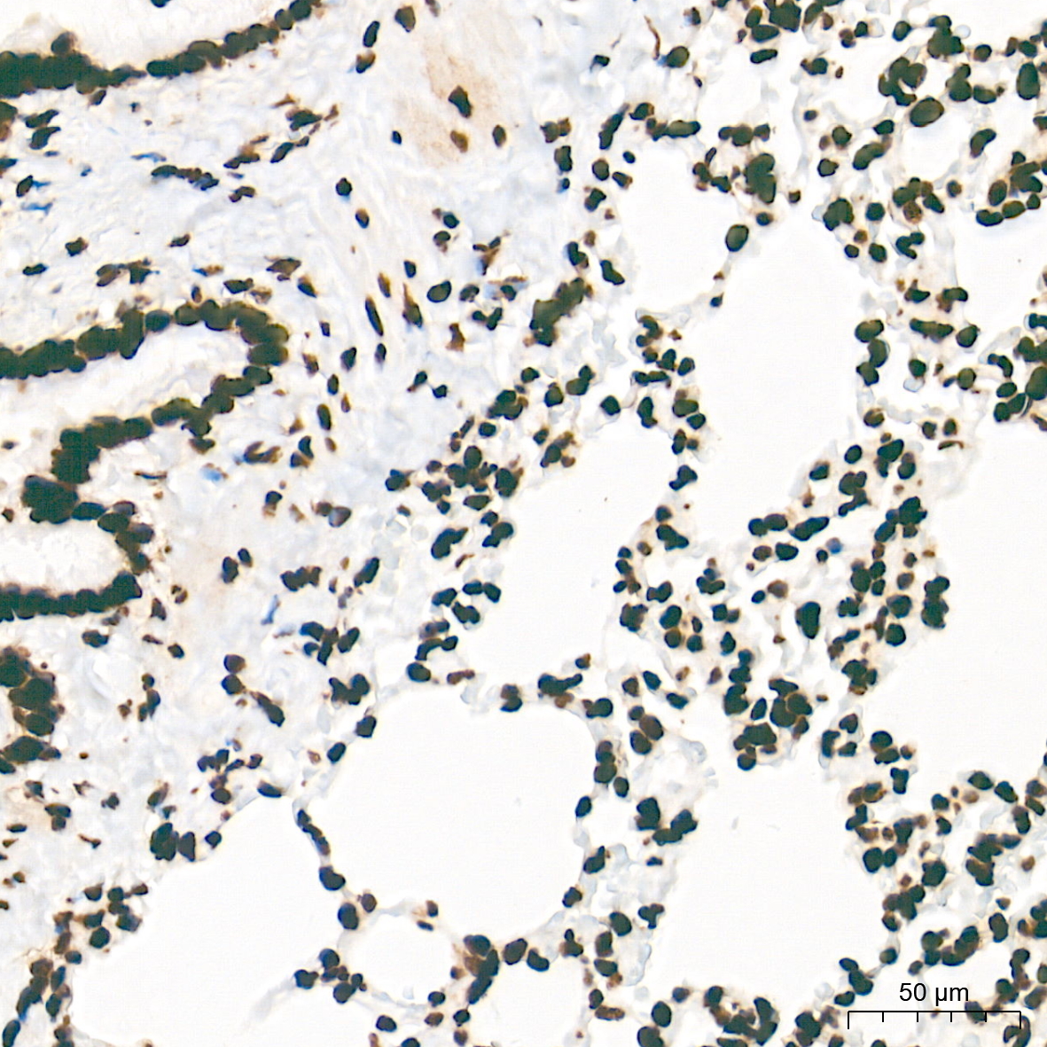 TriMethyl-Histone H3-K27 Rabbit mAb