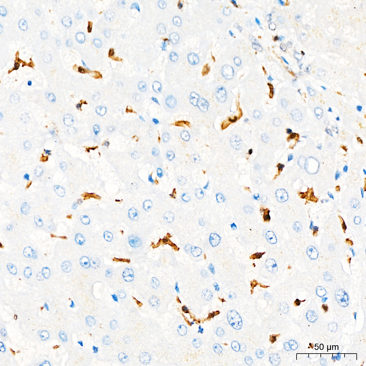 ASC/TMS1 Rabbit mAb