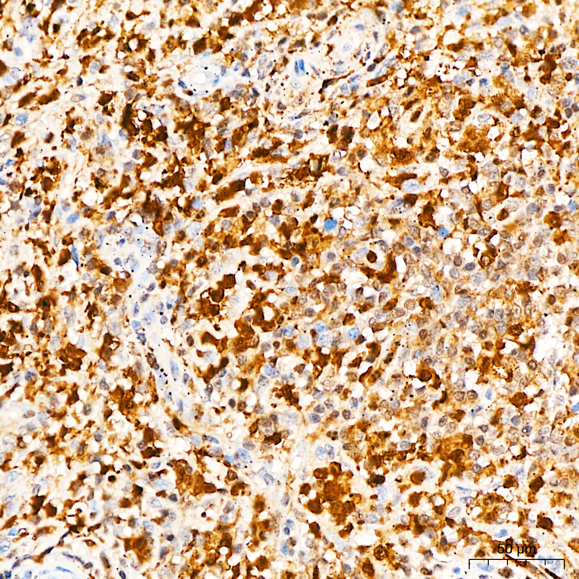 ASC/TMS1 Rabbit mAb