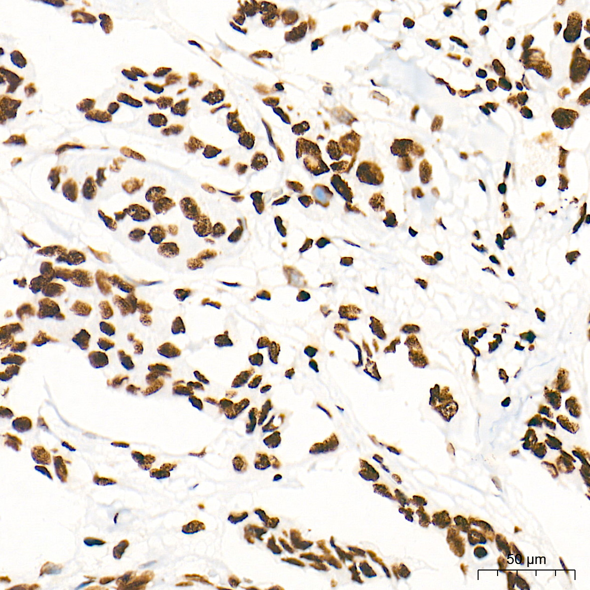 DiMethyl-Histone H3-K79 Rabbit mAb
