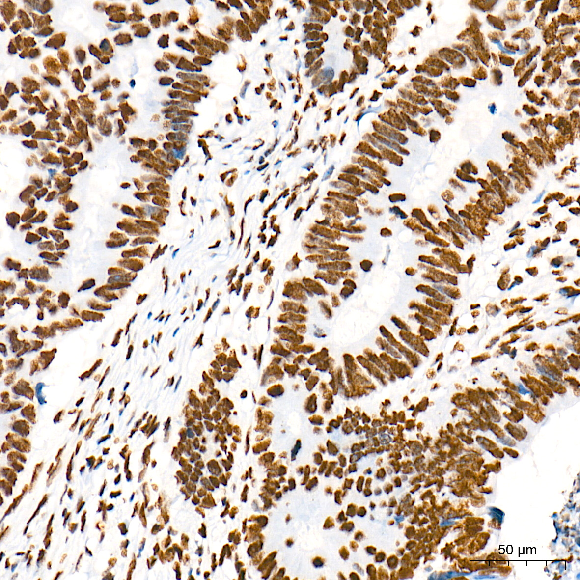 DiMethyl-Histone H3-K79 Rabbit mAb