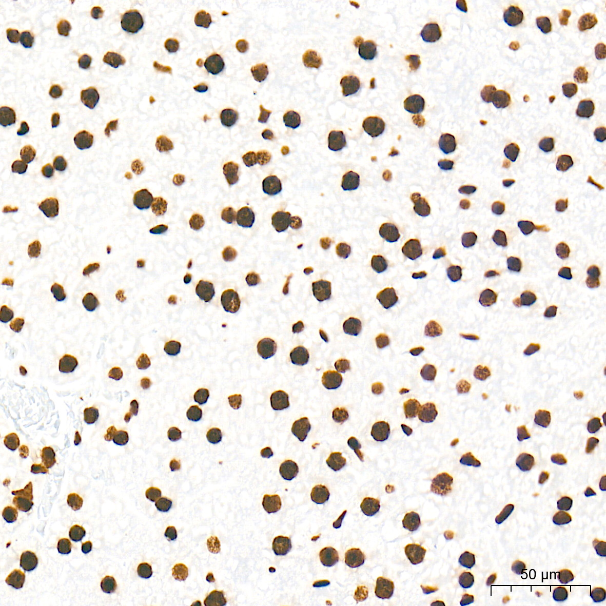 DiMethyl-Histone H3-K79 Rabbit mAb