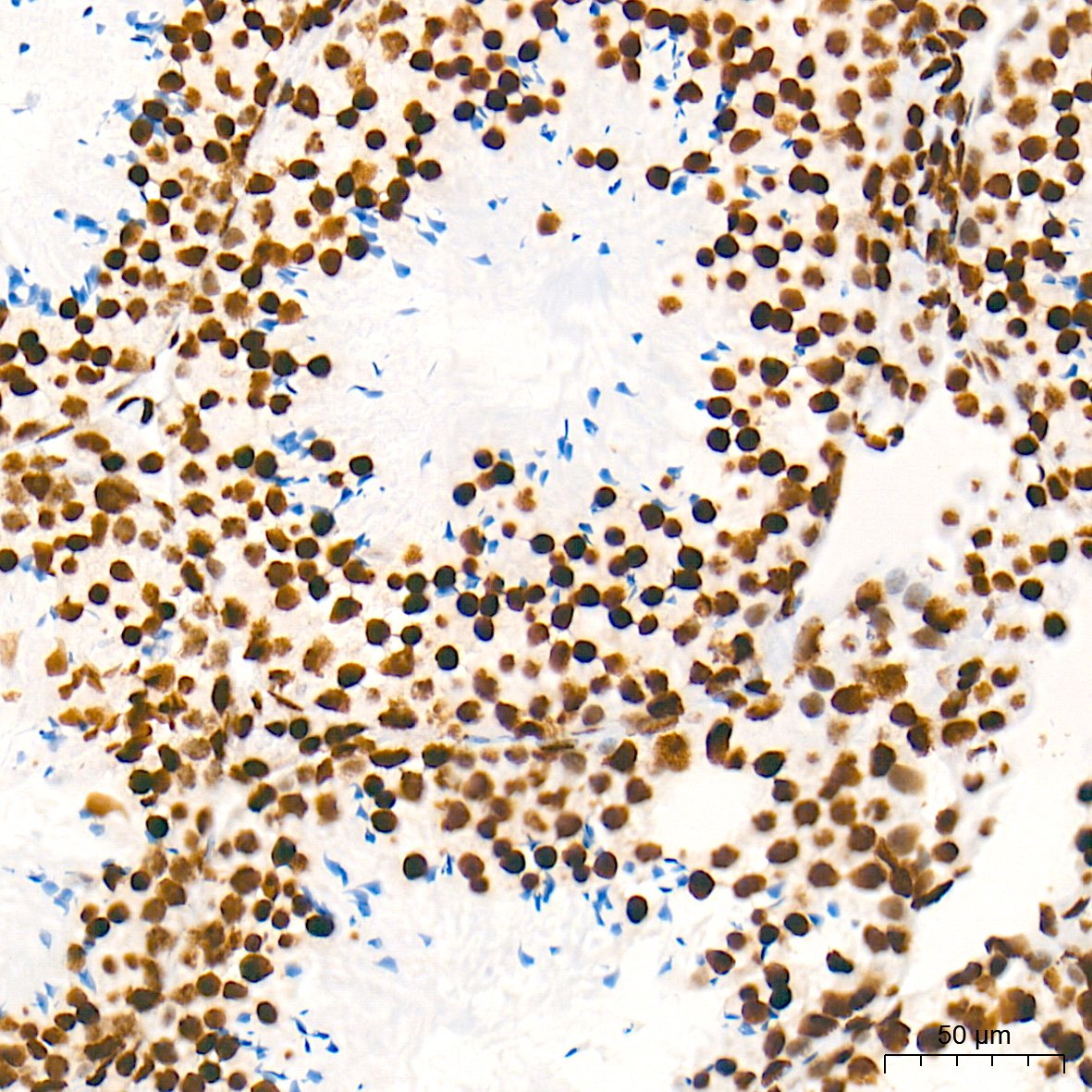 DiMethyl-Histone H3-K79 Rabbit mAb