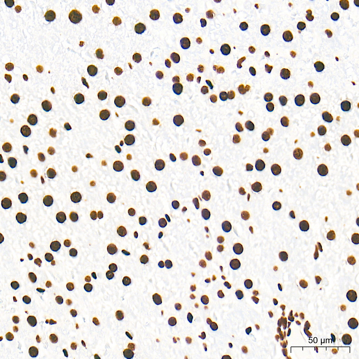 DiMethyl-Histone H3-K79 Rabbit mAb