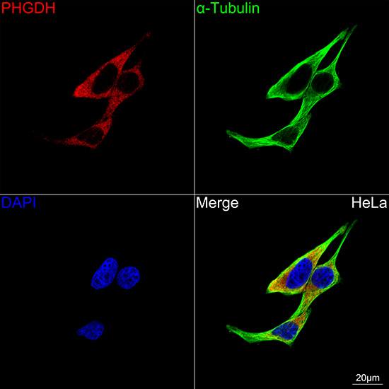 PHGDH Rabbit mAb
