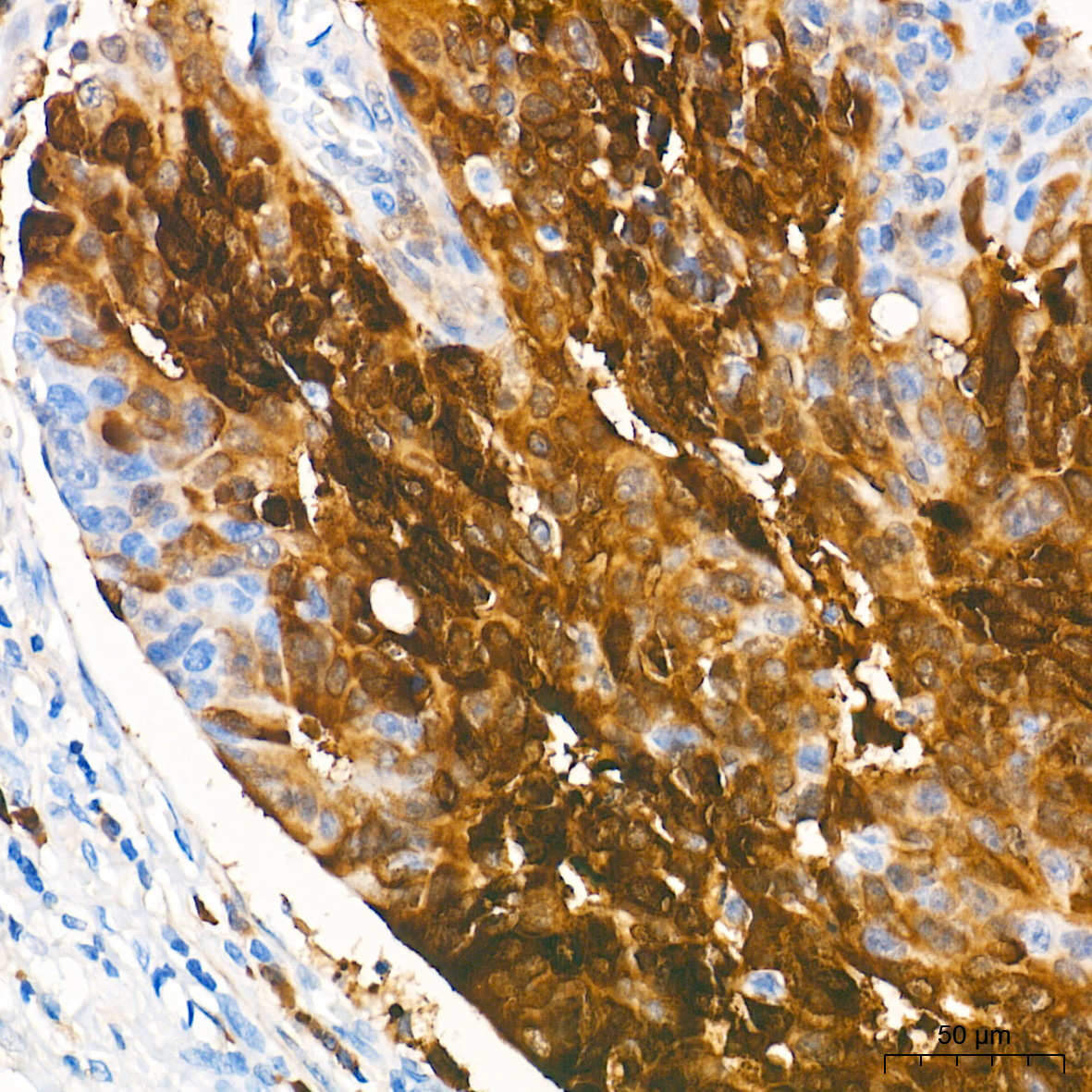 PHGDH Rabbit mAb