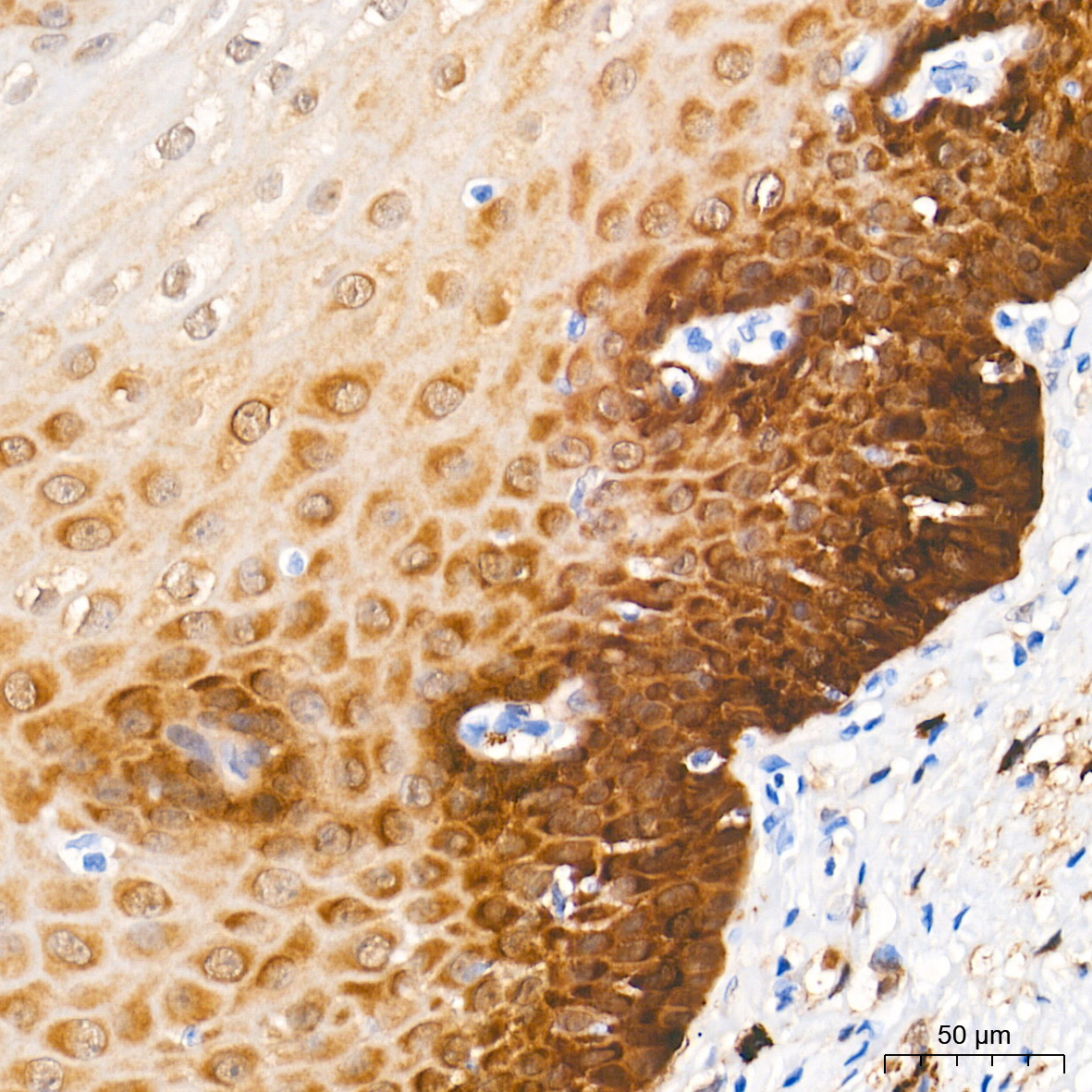 PHGDH Rabbit mAb